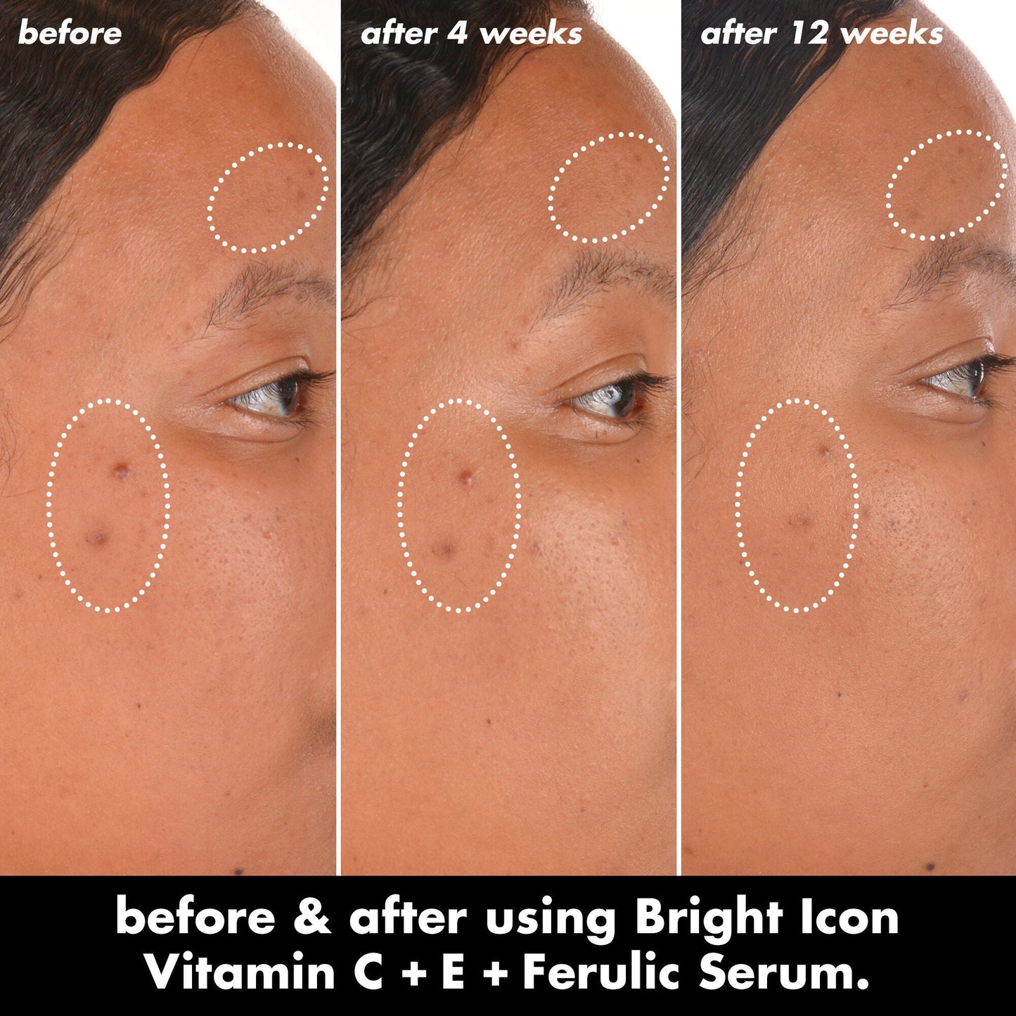 bright-icon-vitamin-c-e-ferulic-serum-v8 0226_EDU_BrightIconVitC_BA_Chanel_TRIPTYCH_c58f2fc8-209d-414f-9ba3-666a07a94887.jpg