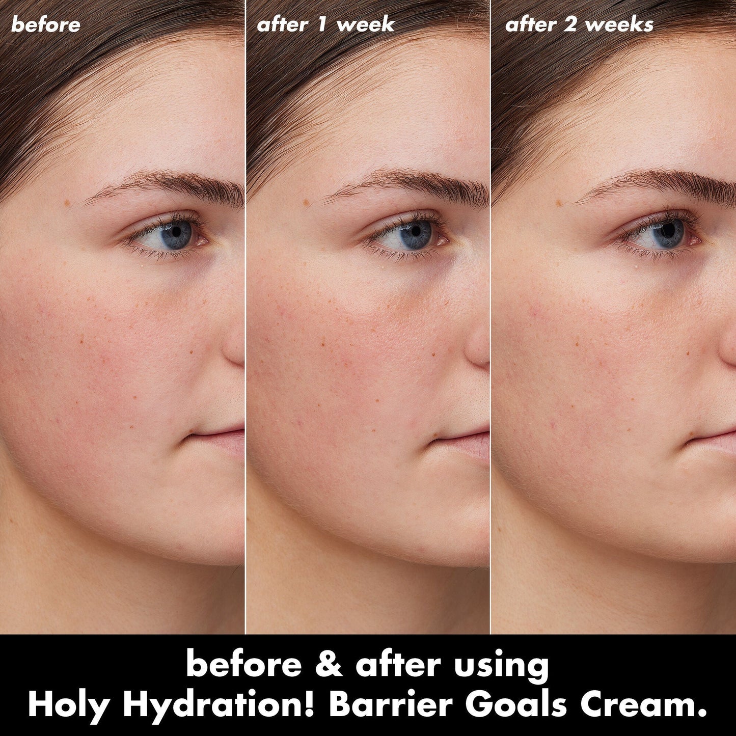 holy-hydration-barrier-goals-cream-mini-k9 0226_EDU_HHBarrierGoalsCream_B_A_Zoe_TRYPTICH_4f0e5b5d-35fb-4020-968e-244d4536afbd.jpg