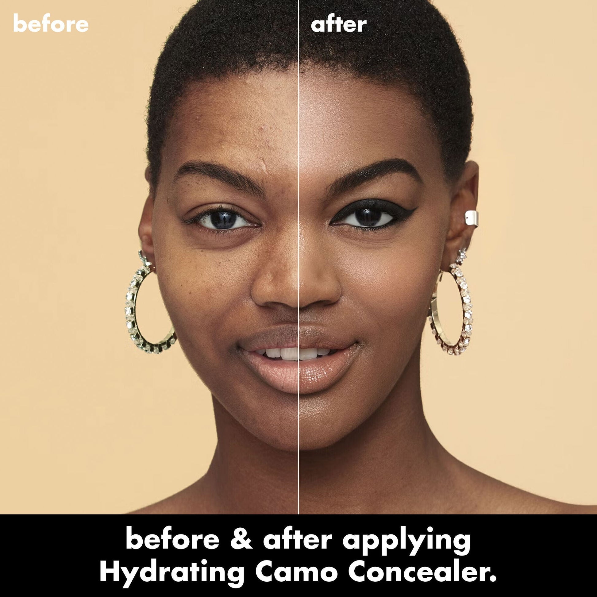 hydrating-camo-concealer-r3 0226_EDU_HydratingCamoConcelaer_BA_AshleyKaresh_20_1_d8499bbf-0e91-4173-b5e2-75127caf83a3.jpg