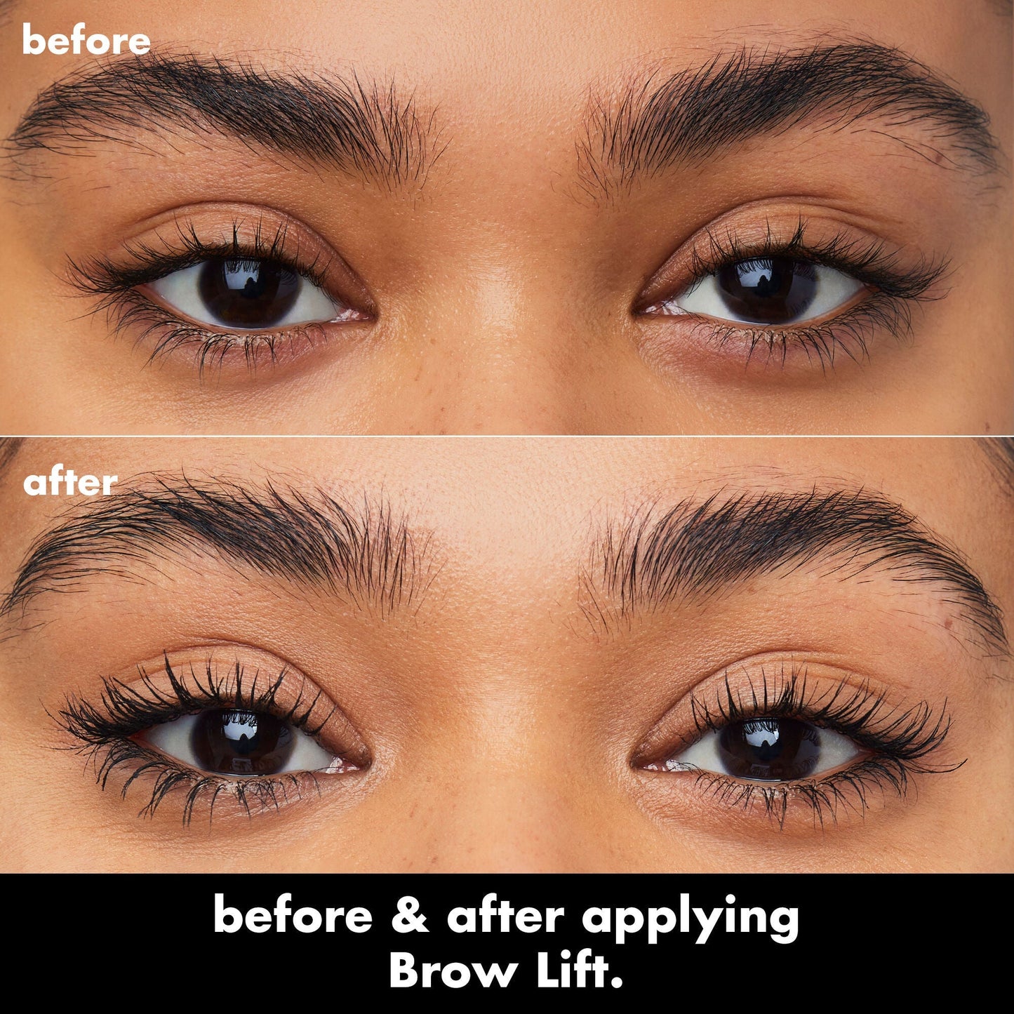 brow-lift-y0 0326_EDU_BrowLift_BA.jpg