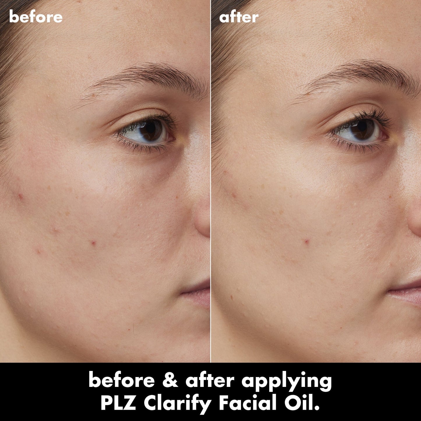 plz-clarify-facial-oil-n5 0326_EDU_PlzClarify_BA_Kelly.jpg