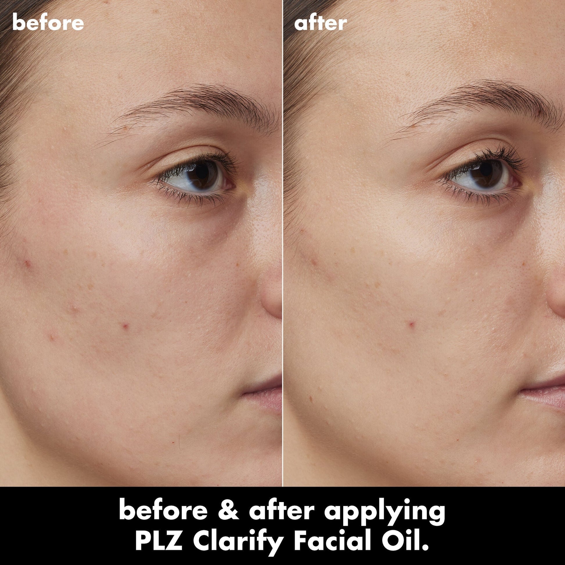 plz-clarify-facial-oil-n5 0326_EDU_PlzClarify_BA_Kelly.jpg