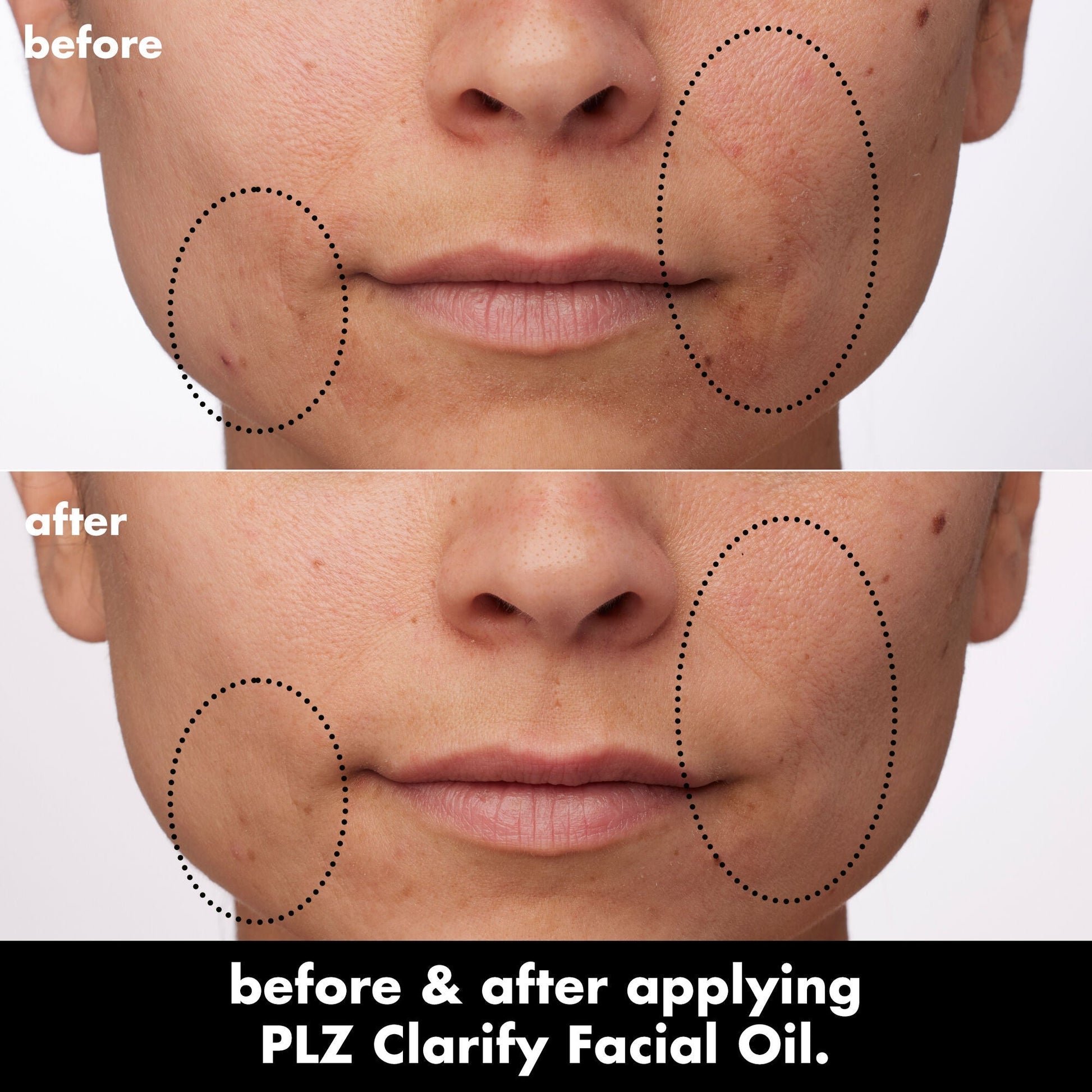plz-clarify-facial-oil-n5 0326_EDU_PlzClarify_BA_Paula.jpg