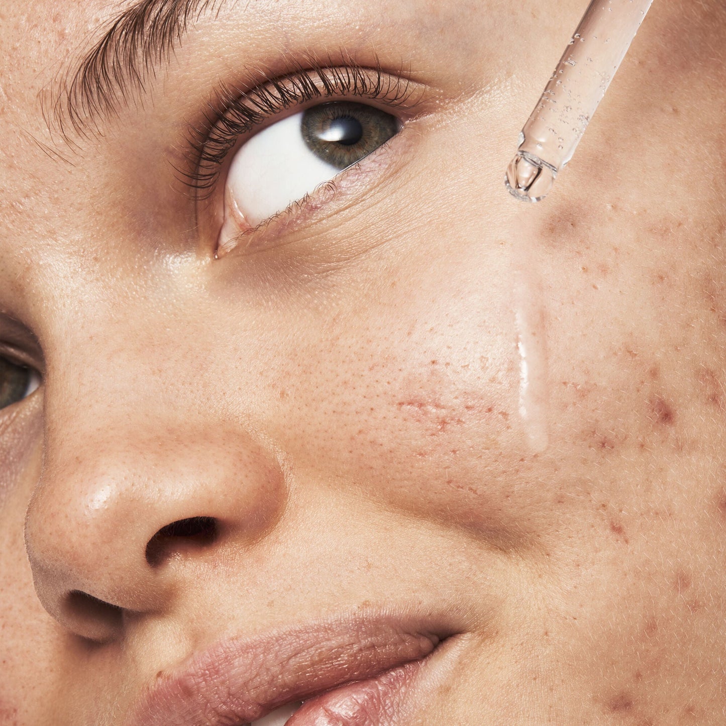 blemish-breakthrough-triple-acid-resurfacing-serum-l0 121321_Marley-Acne-Regimen_0254_FINAL_IGF.jpg