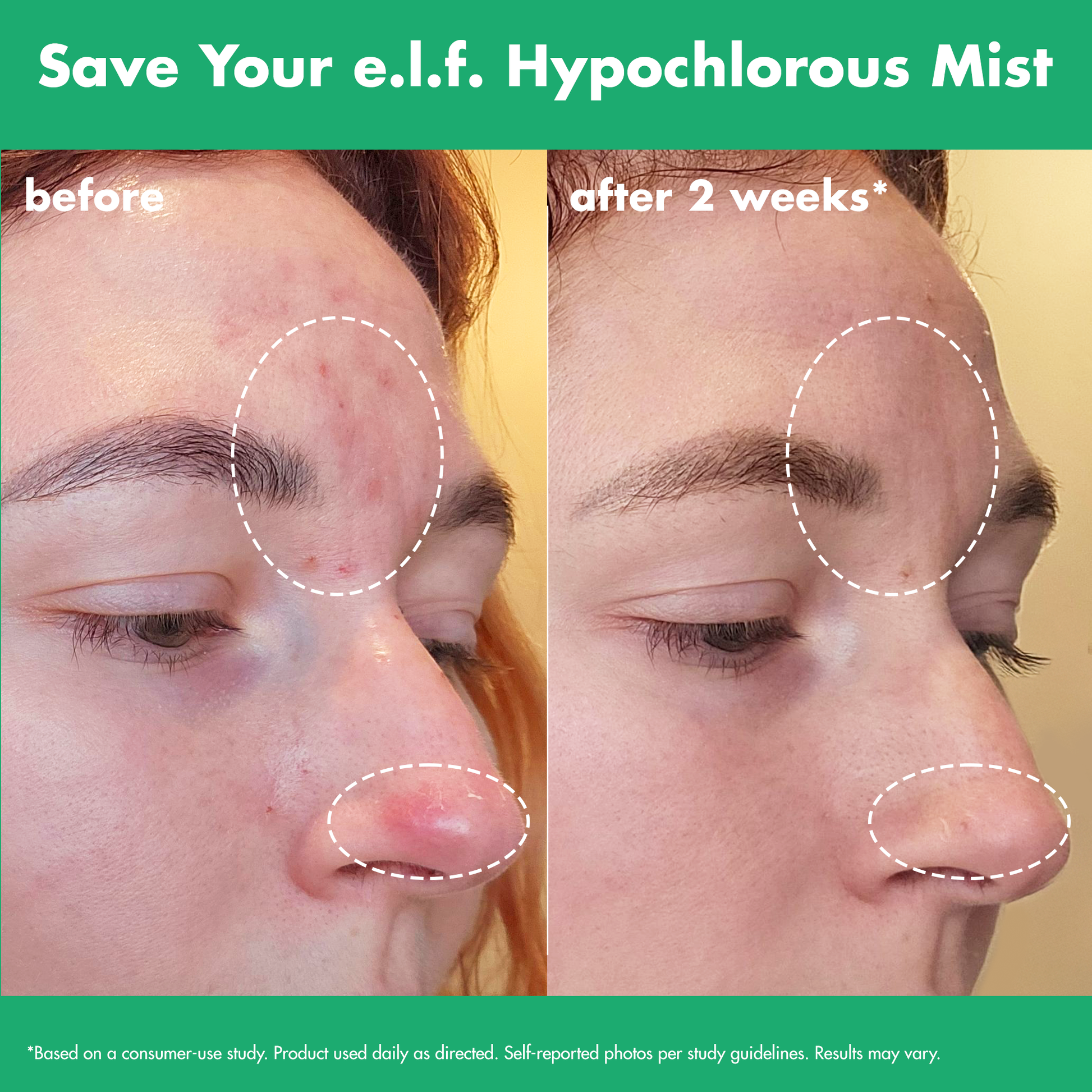 save-your-e-l-f-hypochlorous-mist-r2 FA26_EDUCATION_SAVEYOURELF_USAGE_BA1_WITHOUT_CLAIMS.png