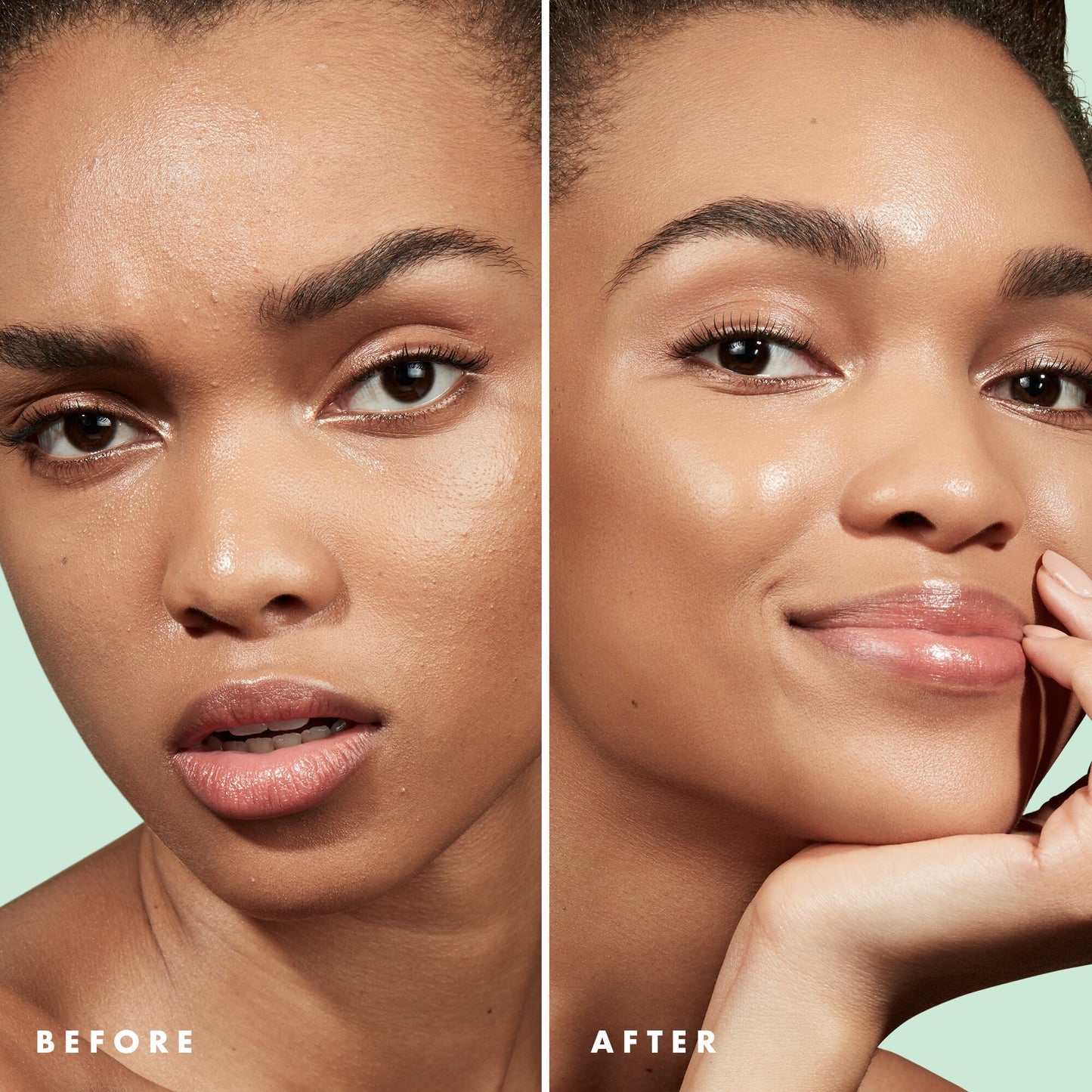 blemish-control-face-primer-large-size-a5 Primer_PP_Before_After_BlemishControl_2000x2000_3774231e-d4e1-49dd-b3d7-a73cbac901fe.jpg